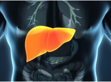 How Can You Naturally Lose the Fat That is on Your Liver?